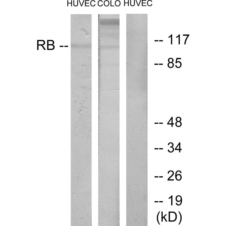 Western Blot - Anti-Retinoblastoma Antibody (B7209) - Antibodies.com