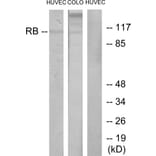 Western Blot - Anti-Retinoblastoma Antibody (B7209) - Antibodies.com