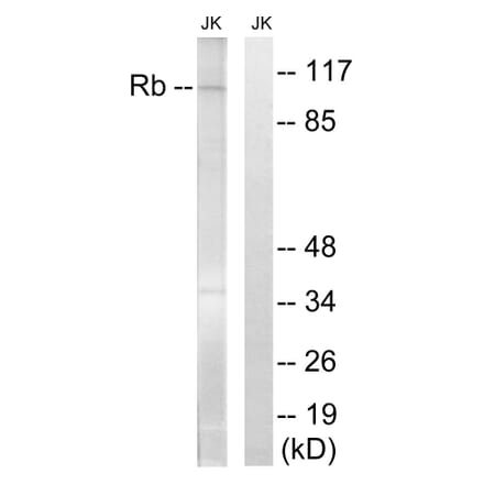 Western Blot - Anti-Retinoblastoma Antibody (B8059) - Antibodies.com