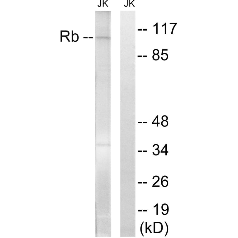 Western Blot - Anti-Retinoblastoma Antibody (B8059) - Antibodies.com