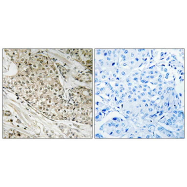 Immunohistochemistry - Anti-Retinoblastoma Antibody (B8059) - Antibodies.com