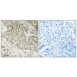 Immunohistochemistry - Anti-Retinoblastoma Antibody (B8059) - Antibodies.com