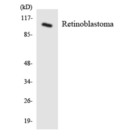 Western Blot - Anti-Retinoblastoma Antibody (R12-3422) - Antibodies.com