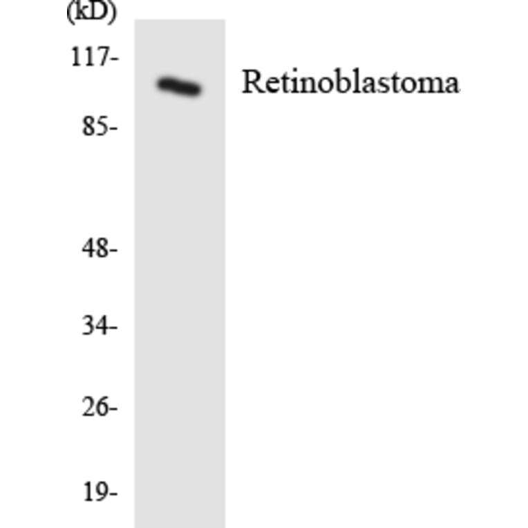 Western Blot - Anti-Retinoblastoma Antibody (R12-3422) - Antibodies.com