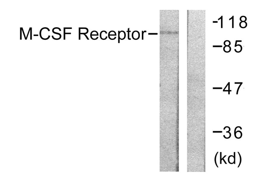 Western Blot - Anti-M-CSF Receptor Antibody (B0507) - Antibodies.com