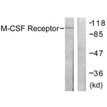 Western Blot - Anti-M-CSF Receptor Antibody (B0507) - Antibodies.com