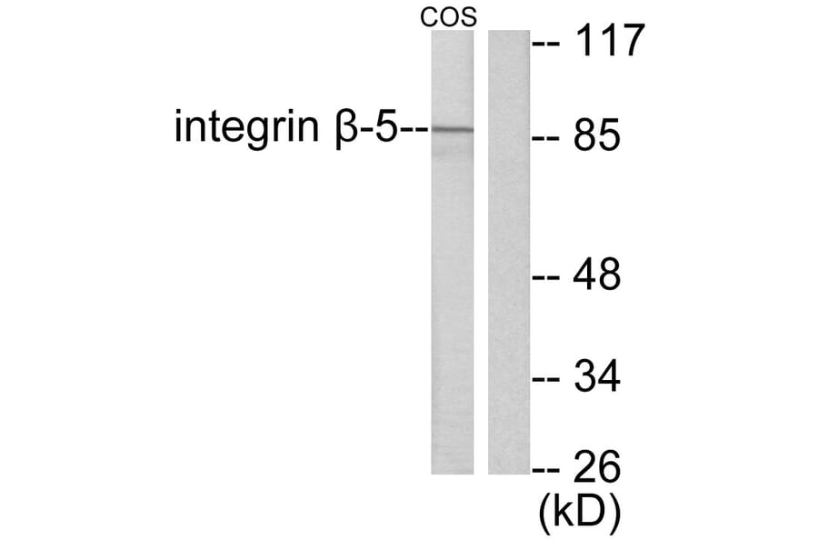 Western Blot - Anti-Integrin beta5 Antibody (C0235) - Antibodies.com