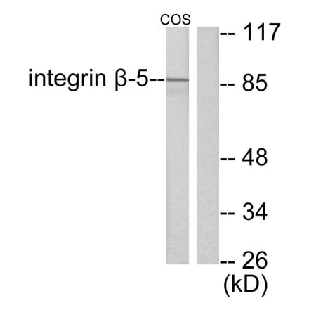 Western Blot - Anti-Integrin beta5 Antibody (C0235) - Antibodies.com