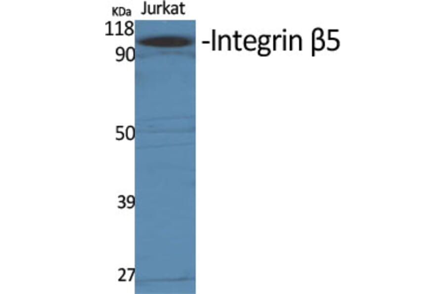 Western Blot - Anti-Integrin beta5 Antibody (C0235) - Antibodies.com