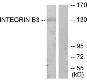 Western Blot - Anti-Integrin beta3 Antibody (B7118) - Antibodies.com