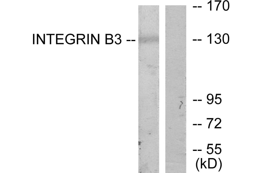 Western Blot - Anti-Integrin beta3 Antibody (B7118) - Antibodies.com