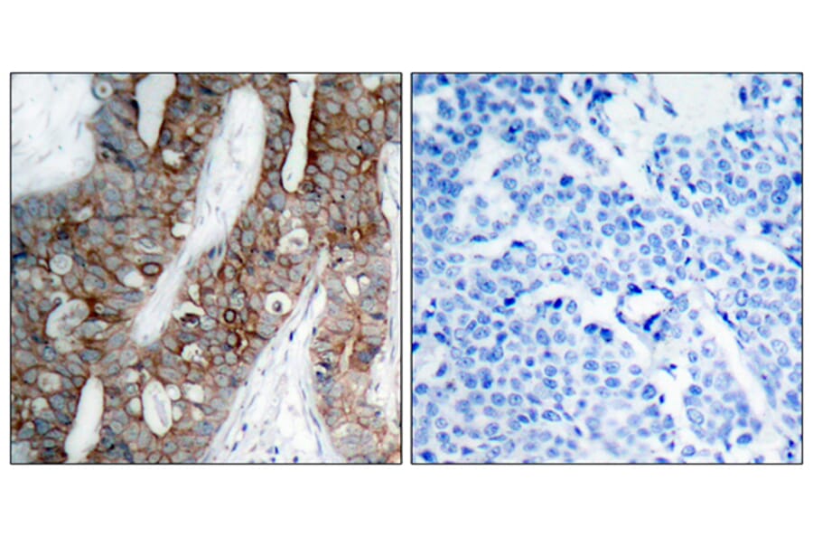 Immunohistochemistry - Anti-Integrin beta3 Antibody (B7118) - Antibodies.com