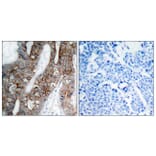 Immunohistochemistry - Anti-Integrin beta3 Antibody (B7118) - Antibodies.com