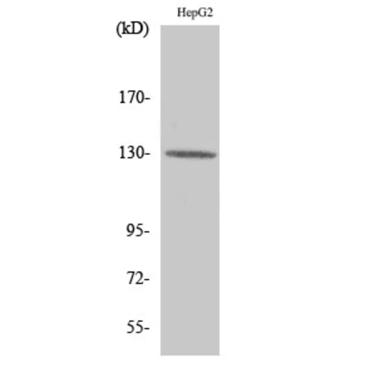 Western Blot - Anti-Integrin beta3 Antibody (B7118) - Antibodies.com