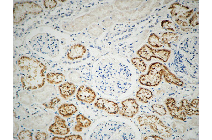 Immunohistochemistry - Anti-Integrin beta1 Antibody (B0445) - Antibodies.com