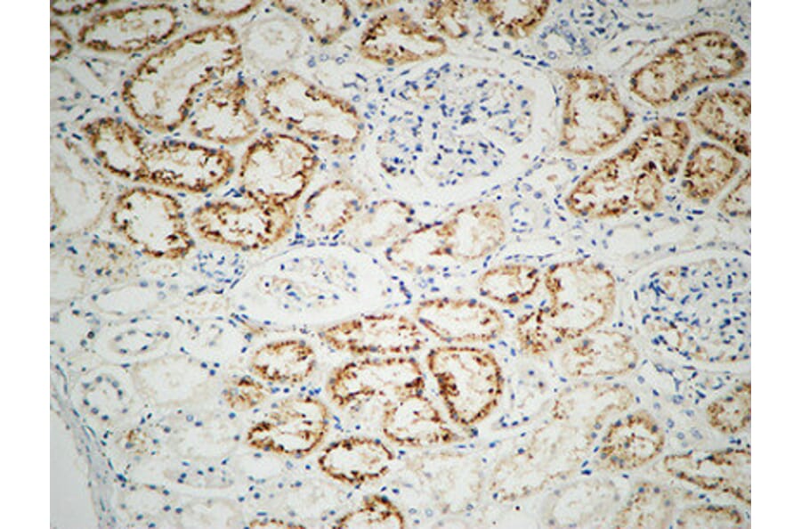 Immunohistochemistry - Anti-Integrin beta1 Antibody (B0445) - Antibodies.com