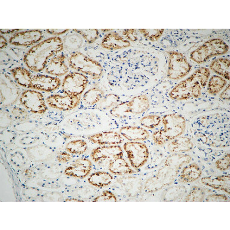 Immunohistochemistry - Anti-Integrin beta1 Antibody (B0445) - Antibodies.com