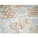Immunohistochemistry - Anti-Integrin beta1 Antibody (B0445) - Antibodies.com