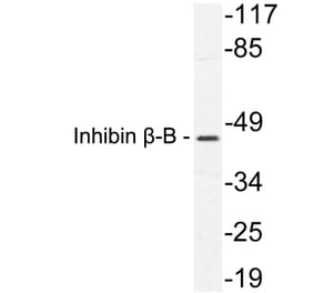 Western Blot - Anti-Inhibin beta-B Antibody (R12-2216) - Antibodies.com