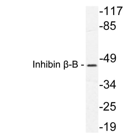 Western Blot - Anti-Inhibin beta-B Antibody (R12-2216) - Antibodies.com