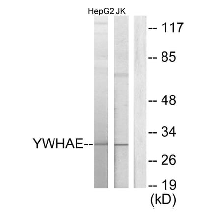 Western Blot - Anti-14-3-3 epsilon Antibody (C12002) - Antibodies.com