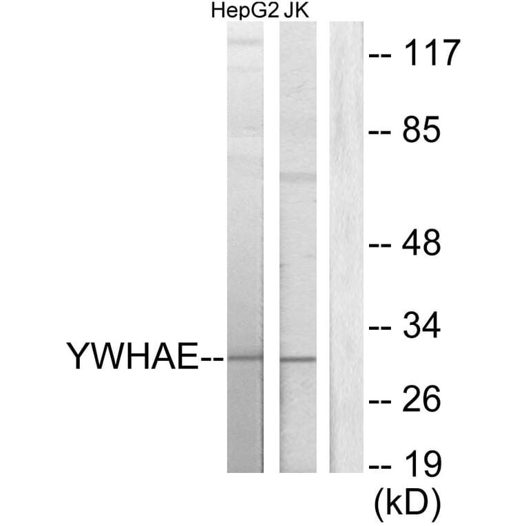 Western Blot - Anti-14-3-3 epsilon Antibody (C12002) - Antibodies.com