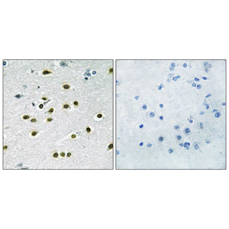 Immunohistochemistry - Anti-KLF10 + KLF11 Antibody (C10948) - Antibodies.com
