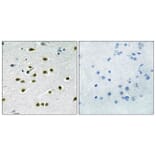 Immunohistochemistry - Anti-KLF10 + KLF11 Antibody (C10948) - Antibodies.com