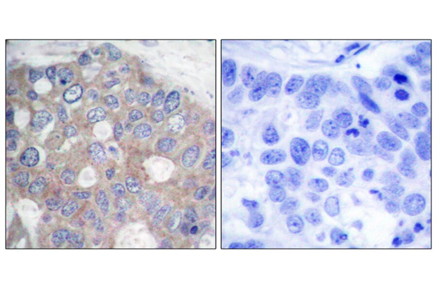 Immunohistochemistry - Anti-p70 S6 Kinase Antibody (B7190) - Antibodies.com