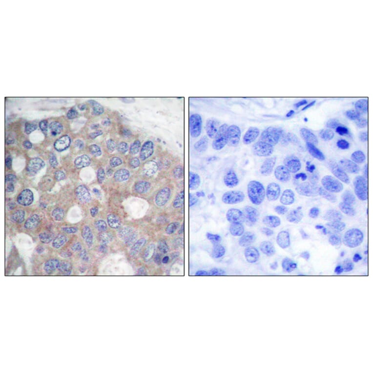Immunohistochemistry - Anti-p70 S6 Kinase Antibody (B7190) - Antibodies.com