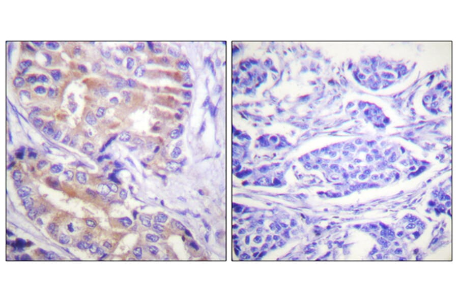 Immunohistochemistry - Anti-p70 S6 Kinase Antibody (B0533) - Antibodies.com