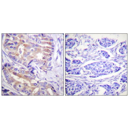 Immunohistochemistry - Anti-p70 S6 Kinase Antibody (B0533) - Antibodies.com