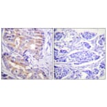 Immunohistochemistry - Anti-p70 S6 Kinase Antibody (B0533) - Antibodies.com