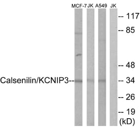 Western Blot - Anti-Calsenilin Antibody (B1024) - Antibodies.com