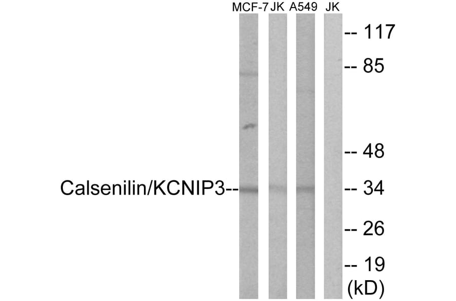 Western Blot - Anti-Calsenilin Antibody (B1024) - Antibodies.com
