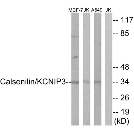 Western Blot - Anti-Calsenilin Antibody (B1024) - Antibodies.com