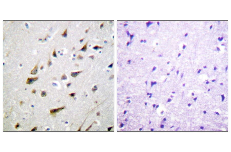 Immunohistochemistry - Anti-Calsenilin Antibody (B1024) - Antibodies.com