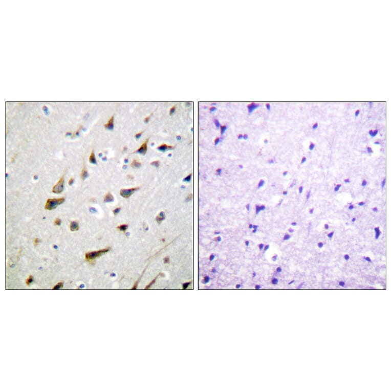 Immunohistochemistry - Anti-Calsenilin Antibody (B1024) - Antibodies.com