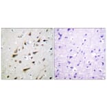 Immunohistochemistry - Anti-Calsenilin Antibody (B1024) - Antibodies.com