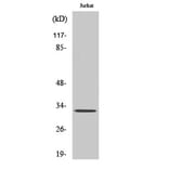 Western Blot - Anti-Calsenilin Antibody (B1024) - Antibodies.com