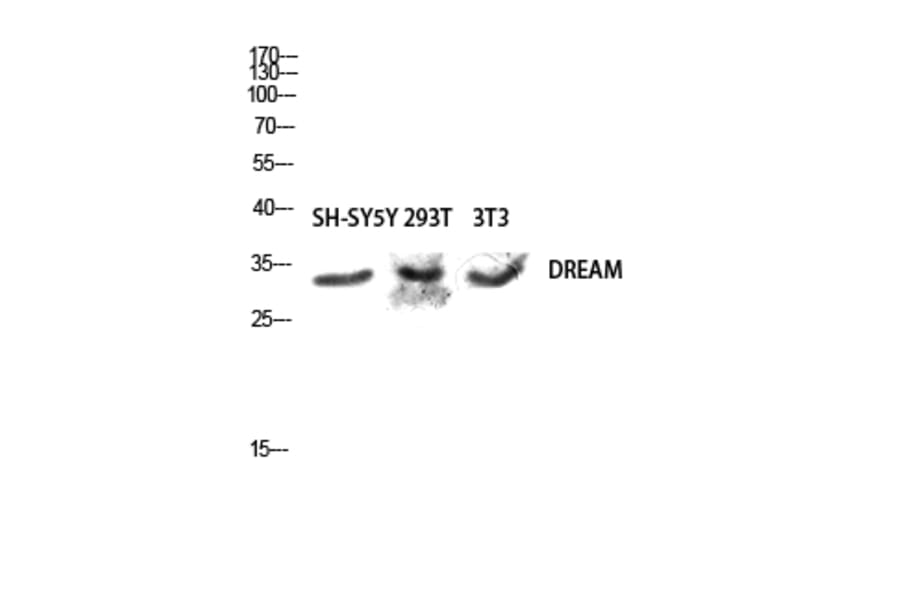 Western Blot - Anti-Calsenilin Antibody (B1024) - Antibodies.com