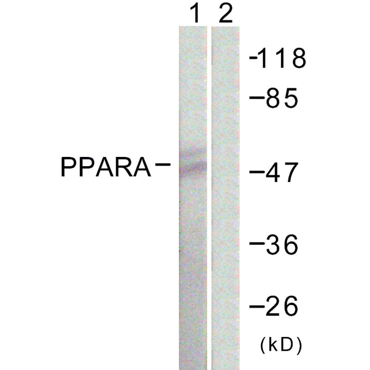 Western Blot - Anti-PPAR-alpha Antibody (B0975) - Antibodies.com