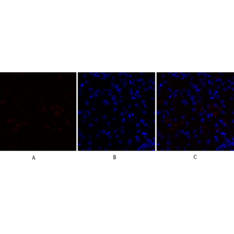 Immunofluorescence - Anti-PPAR-alpha Antibody (B0975) - Antibodies.com