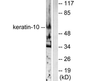 Western Blot - Anti-Keratin 10 Antibody (C0249) - Antibodies.com