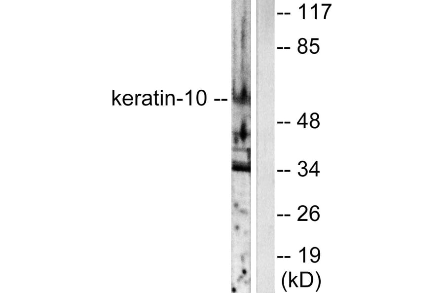 Western Blot - Anti-Keratin 10 Antibody (C0249) - Antibodies.com
