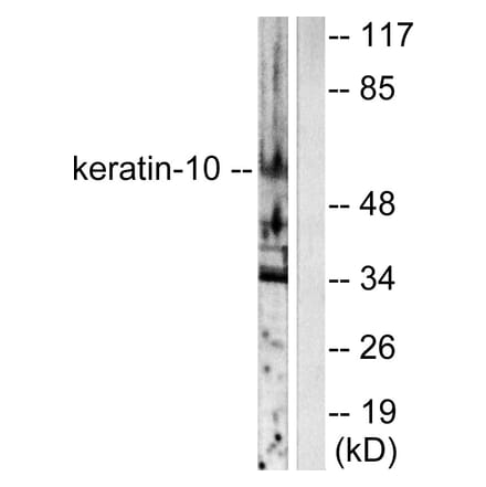 Western Blot - Anti-Keratin 10 Antibody (C0249) - Antibodies.com