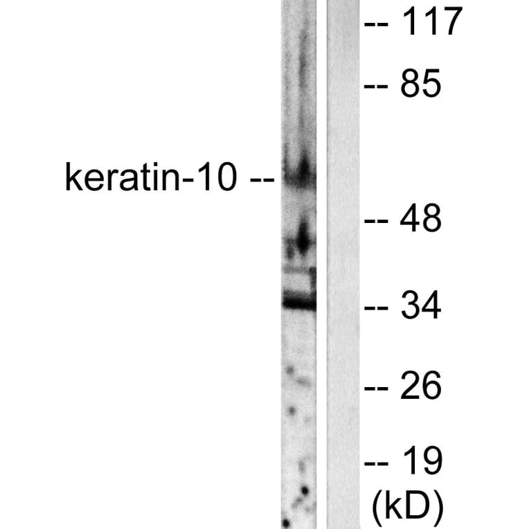 Western Blot - Anti-Keratin 10 Antibody (C0249) - Antibodies.com