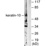 Western Blot - Anti-Keratin 10 Antibody (C0249) - Antibodies.com