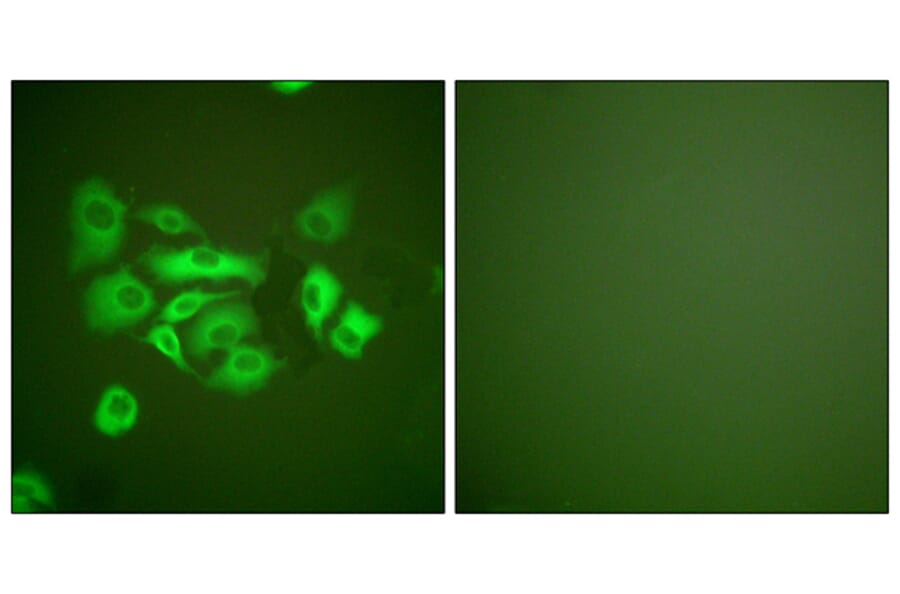 Immunofluorescence - Anti-Keratin 10 Antibody (C0249) - Antibodies.com