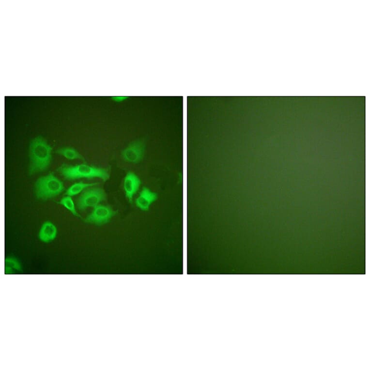 Immunofluorescence - Anti-Keratin 10 Antibody (C0249) - Antibodies.com